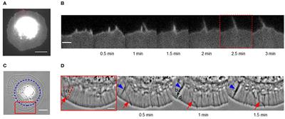 Biomechanical Aspects of Actin Bundle Dynamics